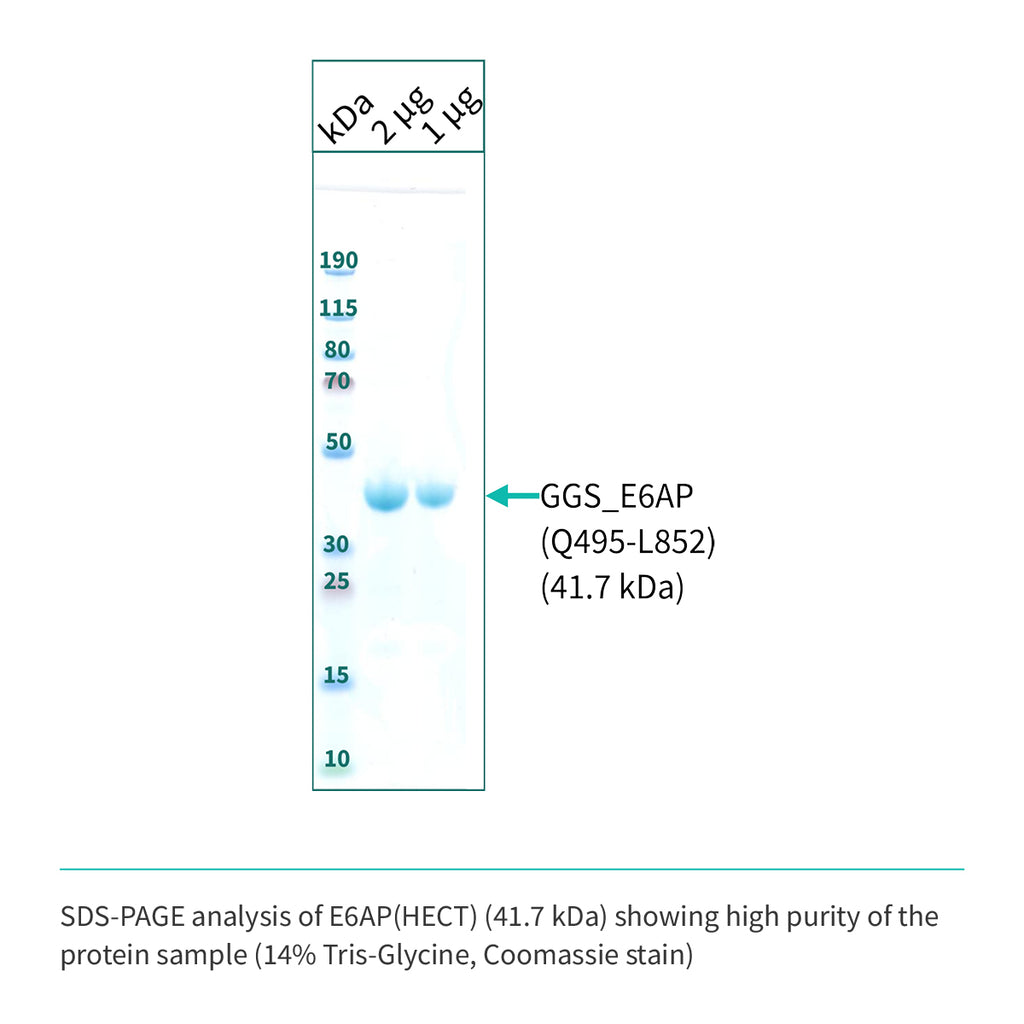 Recombinant <b>E6AP</b>(Q495-L852), HECT domain, E3 Ligase, E6-associated protein, UBE3A