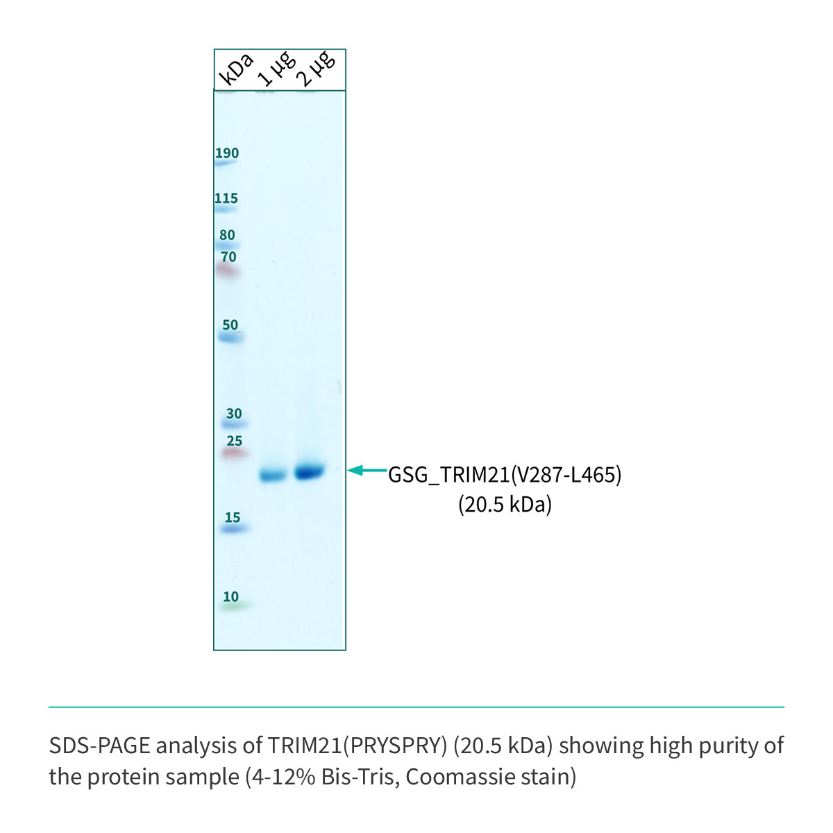 SOON AVAILABLE: <br> Recombinant <b>TRIM21</b>(V287-L465), PRYSPRY domain, Tripartite motif-containing 21 protein, E3 Ligase