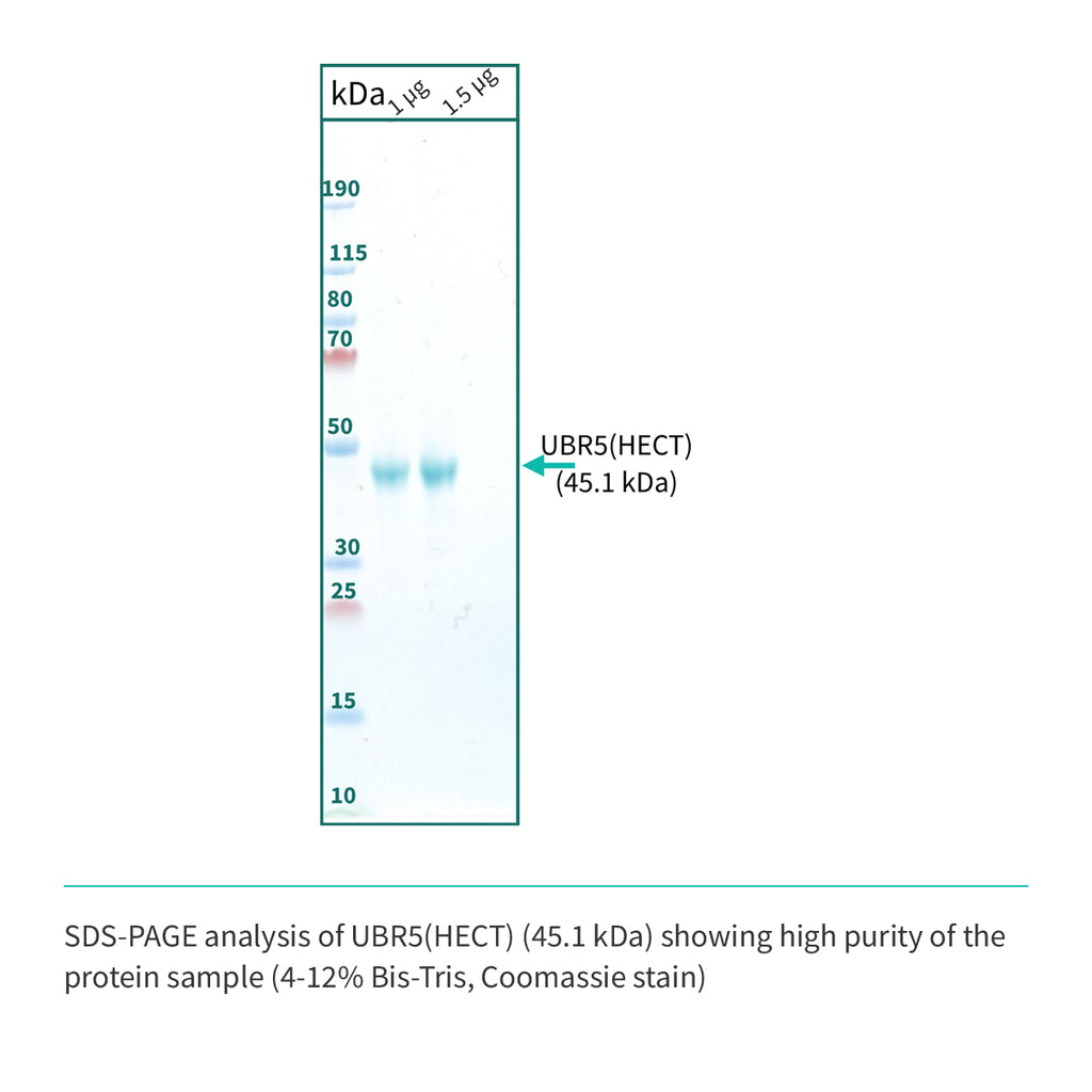 Recombinant <b>UBR5</b> (G2216-V2799)GSGSGS(ΔE2307-D2499), HECT Domain, Ubiquitin Protein E3 Ligase Component N-Recognin 5
