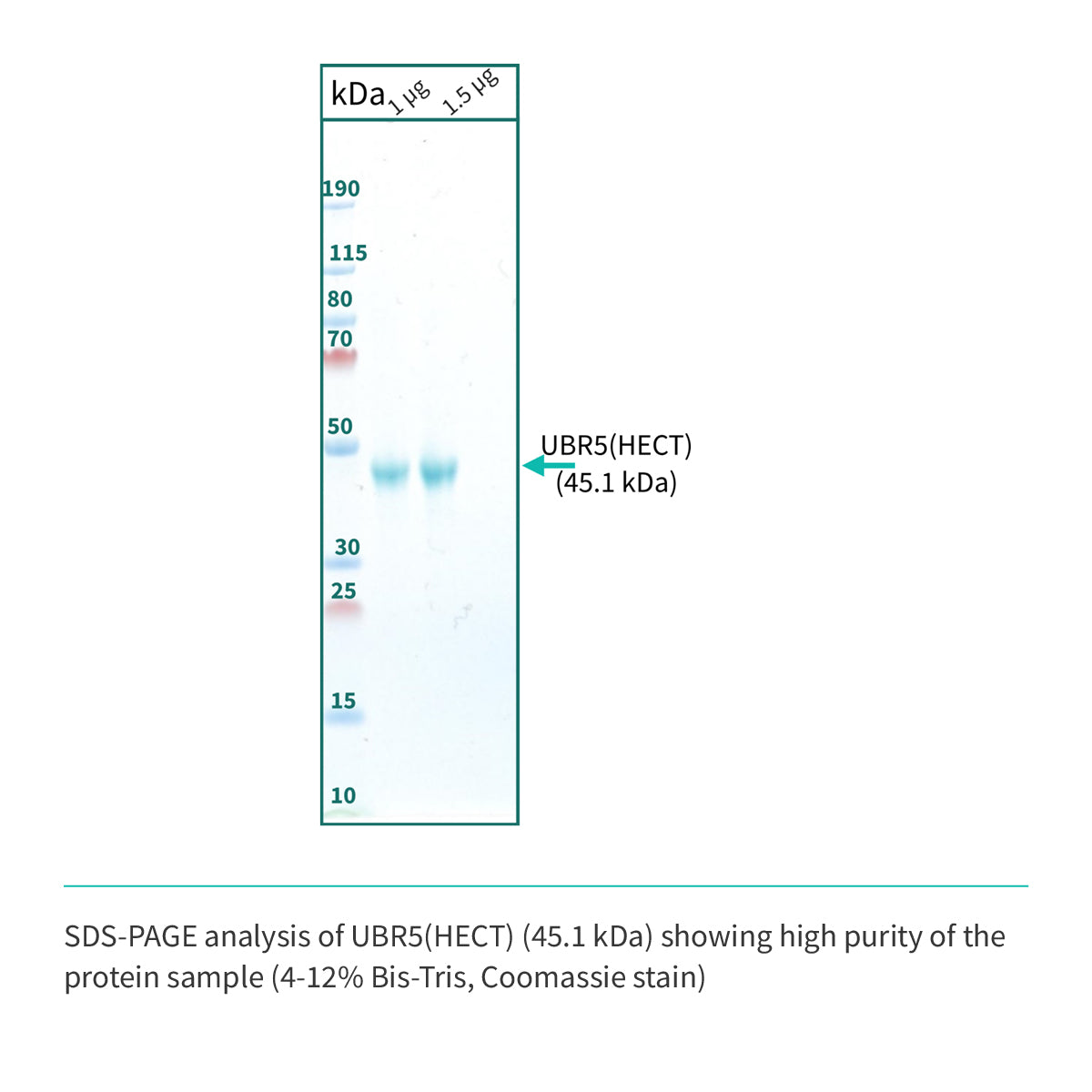 Recombinant <b>UBR5</b> (G2216-V2799)GSGSGS(ΔE2307-D2499), HECT Domain, Ubiquitin Protein E3 Ligase Component N-Recognin 5